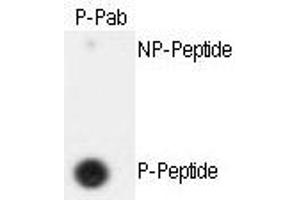 Image no. 2 for anti-Extra Spindle Poles Like 1 (ESPL1) (pSer1126) antibody (ABIN358223) (Separase 抗体  (pSer1126))