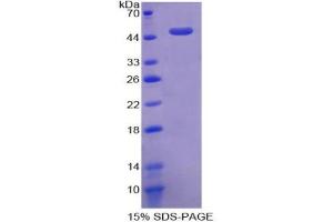 SDS-PAGE analysis of Human ACVR1 Protein. (ACVR1 蛋白)