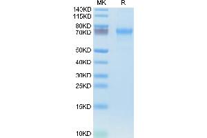 SDS-PAGE (SDS) image for Chemokine (C-X-C Motif) Ligand 16 (CXCL16) (AA 30-205) protein (Fc Tag) (ABIN7274444)