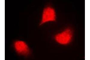 Immunofluorescent analysis of MKK4 (pT261) staining in NIH3T3 cells. (MAP2K4 抗体  (pSer261))