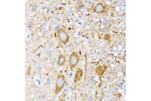 Immunohistochemistry of paraffin-embedded mouse spinal cord using HSPH1 antibody. (HSPH1 抗体)