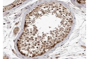 ABIN6267003 at 1/100 staining human Testis tissue sections by IHC-P. (HSP90AA1 抗体  (C-Term))