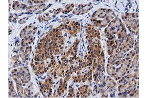 Immunohistochemical staining of paraffin-embedded Carcinoma of Human kidney tissue using anti-CBWD1 mouse monoclonal antibody. (CBWD1 抗体)