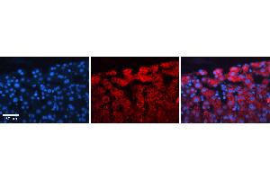 Rabbit Anti-ACLY Antibody   Formalin Fixed Paraffin Embedded Tissue: Human Liver Tissue Observed Staining: Cytoplasm in hepatocytes Primary Antibody Concentration: 1:100 Other Working Concentrations: N/A Secondary Antibody: Donkey anti-Rabbit-Cy3 Secondary Antibody Concentration: 1:200 Magnification: 20X Exposure Time: 0. (ACLY 抗体  (Middle Region))