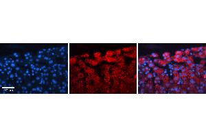 Rabbit Anti-ACLY Antibody   Formalin Fixed Paraffin Embedded Tissue: Human Liver Tissue Observed Staining: Cytoplasm in hepatocytes Primary Antibody Concentration: 1:100 Other Working Concentrations: N/A Secondary Antibody: Donkey anti-Rabbit-Cy3 Secondary Antibody Concentration: 1:200 Magnification: 20X Exposure Time: 0. (ACLY 抗体  (Middle Region))