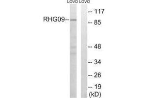 Western blot analysis of extracts from LOVO cells, using RHG9 antibody. (ARHGAP9 抗体)