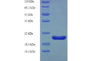 SDS-PAGE (SDS) image for Regenerating Islet-Derived 3 alpha (REG3A) (AA 26-174) protein (His tag) (ABIN5710237)