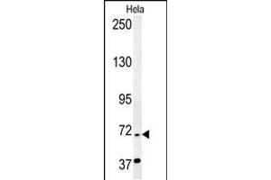 RAD26 Antibody (N-term) (ABIN654126 and ABIN2844001) western blot analysis in Hela cell line lysates (35 μg/lane). (ERCC6 抗体  (N-Term))