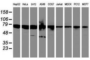 Image no. 4 for anti-serine Peptidase Inhibitor, Kunitz Type 1 (SPINT1) antibody (ABIN1501109)
