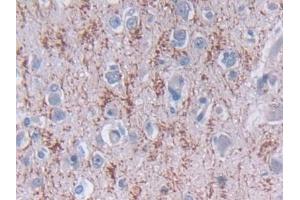 Detection of TDH in Human Cerebrum Tissue using Polyclonal Antibody to L-Threonine Dehydrogenase (TDH) (Tdh 抗体  (AA 1-229))