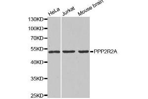Western blot analysis of extracts of various cell lines, using PPP2R2A antibody. (PPP2R2A 抗体  (AA 1-447))