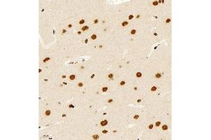 Immunohistochemistry of paraffin embedded rat brain using smad62024 (ABIN7075629) at dilution of 1:1000 (400x lens) (SMAD6 抗体)
