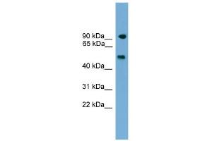 WB Suggested Anti-Parp8 Antibody Titration: 0. (PARP8 抗体  (C-Term))