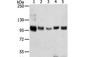 Western Blot analysis of Mouse brain and Human brain tissue, Human prostate tissue, Human fat and placenta tissue using SORT1 Polyclonal Antibody at dilution of 1:200 (Sortilin 1 抗体)