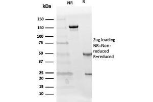 SDS-PAGE Analysis Purified Follistatin Mouse Monoclonal Antibody (FST/4281). (Follistatin 抗体)
