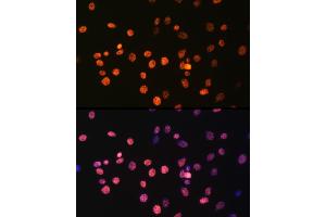 Immunofluorescence analysis of C6 cells using MonoMethyl-Histone H3-R17 Rabbit pAb (ABIN3017467, ABIN3017468, ABIN3017469 and ABIN6220100) at dilution of 100 (40x lens).