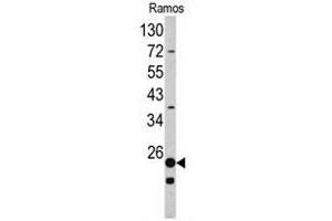 Western blot analysis of RPS9 antibody (C-term) in Ramos cell line lysates (35ug/lane). (RPS9 抗体  (C-Term))