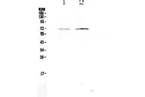 Western blot analysis of CLPX using anti-CLPX antibody . (CLPX 抗体  (AA 337-574))