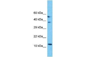 Western Blotting (WB) image for anti-Mitochondrial Ribosomal Protein S18C (MRPS18C) (C-Term) antibody (ABIN2791674) (MRPS18C 抗体  (C-Term))