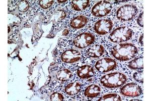 Immunohistochemistry (IHC) analysis of paraffin-embedded Human Colon, antibody was diluted at 1:100.