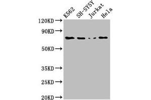 Western Blot Positive WB detected in: K562 whole cell lysate, SH-SY5Y whole cell lysate, Jurkat whole cell lysate, Hela whole cell lysate All lanes: PRKCB antibody at 3 μg/mL Secondary Goat polyclonal to rabbit IgG at 1/50000 dilution Predicted band size: 77, 78 kDa Observed band size: 77 kDa (PKC beta 抗体  (AA 517-643))