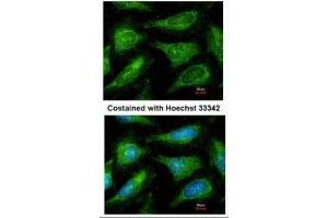 ICC/IF Image Immunofluorescence analysis of methanol-fixed HeLa, using c-Yes, antibody at 1:200 dilution. (YES1 抗体  (Center))