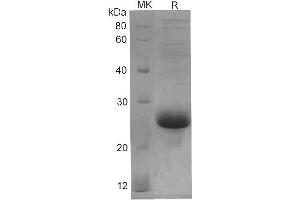 Western Blotting (WB) image for Interleukin 6 (IL6) protein (His tag) (ABIN7319952) (IL-6 Protein (His tag))