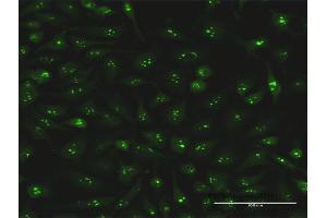 Immunofluorescence of monoclonal antibody to S100A7 on HeLa cell.