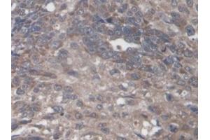 Immunohistochemistry (IHC) image for anti-Protein Tyrosine Phosphatase Receptor Type F (PTPRF) (AA 30-224) antibody (ABIN7444742)