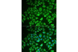 Immunofluorescence analysis of A549 cells using EHHADH antibody. (EHHADH 抗体  (AA 444-723))