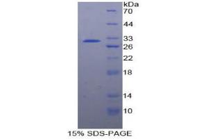 SDS-PAGE analysis of Human PTPRJ Protein. (PTPRJ 蛋白)