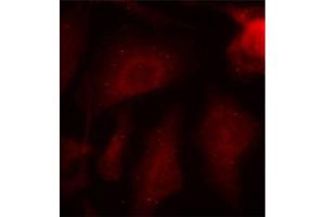 Immunofluorescence staining of methanol-fixed HeLa cells using Phospho-MAPT-S404 antibody (ABIN2987503). (MAPT 抗体  (pSer404))