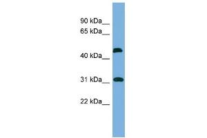 WB Suggested Anti-CTDSP2 Antibody Titration: 0. (CTDSP2 抗体  (N-Term))