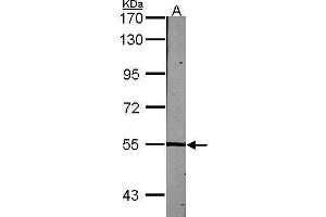 Western Blotting (WB) image for anti-Lymphocyte-Specific Protein tyrosine Kinase (LCK) (C-Term) antibody (ABIN2854996)