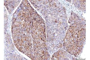 IHC analysis of Poliovirus Receptor/PVR using anti-Poliovirus Receptor/PVR antibody (ABIN7601071).