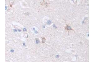 IHC-P analysis of Human Cerebrum Tissue, with DAB staining. (Factor VIII 抗体  (AA 1887-2044))