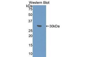 Western Blotting (WB) image for anti-Fibrinogen gamma Chain (FGG) (AA 166-416) antibody (ABIN1078033) (FGG 抗体  (AA 166-416))