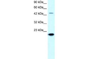 MMP19 antibody used at 5-10 ug/ml to detect target protein. (MMP19 抗体  (C-Term))