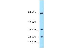 Western Blotting (WB) image for anti-T Cell Receptor gamma Variable 9 (TRGV9) (C-Term) antibody (ABIN2788572)