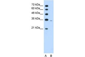 WB Suggested Anti-PRPS2 Antibody Titration:  1. (PRPS2 抗体  (Middle Region))