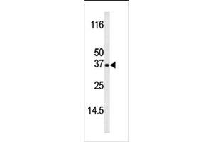 Image no. 1 for anti-BCL2-Interacting Killer (Apoptosis-Inducing) (BIK) (pThr33) antibody (ABIN358090) (BIK 抗体  (pThr33))