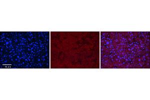 Rabbit Anti-MASP2 Antibody      Formalin Fixed Paraffin Embedded Tissue: Human Adult Liver   Observed Staining: Cytoplasm in hepatocytes, weak signal, wide tissue distribution   Primary Antibody Concentration: 1:100  Secondary Antibody: Donkey anti-Rabbit-Cy3  Secondary Antibody Concentration: 1:200  Magnification: 20X  Exposure Time: 0. (MASP2 抗体  (N-Term))