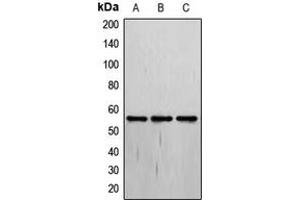 Western blot analysis of THRA expression in MCF7 (A), Jurkat (B), HepG2 (C) whole cell lysates. (THRA 抗体  (N-Term))