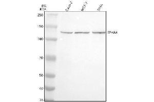 Western blot analysis of EPHA4 using anti-EPHA4 antibody (ABIN7602882).