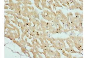 Immunohistochemistry of paraffin-embedded human heart tissue using ABIN7149013 at dilution of 1:100 (CSRP3 抗体  (AA 1-194))