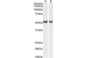 Western Blotting (WB) image for anti-Prostaglandin I2 (Prostacyclin) Synthase (PTGIS) (AA 248-258) antibody (ABIN5539859)