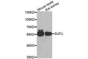 Western blot analysis of extracts of various cell lines, using SUFU antibody. (SUFUH 抗体  (AA 325-484))