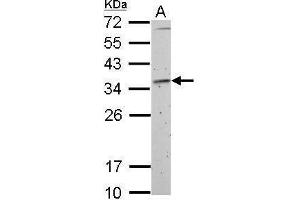 Western Blotting (WB) image for anti-Fibrillarin (FBL) antibody (ABIN2855179)