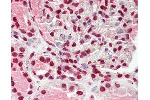 Human Kidney: Formalin-Fixed, Paraffin-Embedded (FFPE)