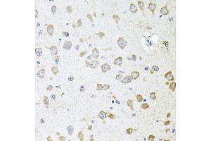 Immunohistochemistry of paraffin-embedded mouse brain using AKAP5 antibody (ABIN5973905) at dilution of 1/100 (40x lens).
